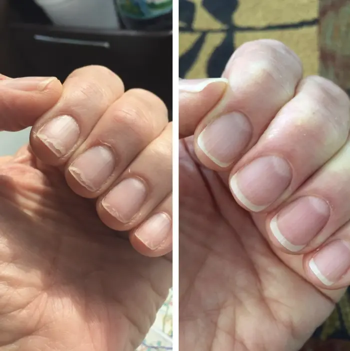 foto di unghie prima e dopo l'applicazione di spirulina